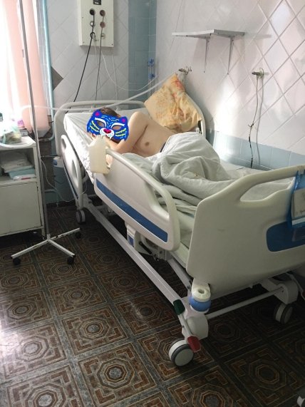 Підлітку в Одесі ампутували обидві ноги