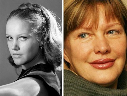 олена проклова пластика