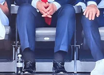 Набухшие лодыжки Трампа