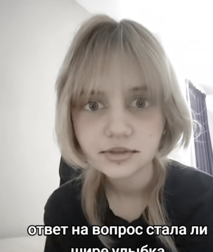 Подрезка уголков рта, тренд