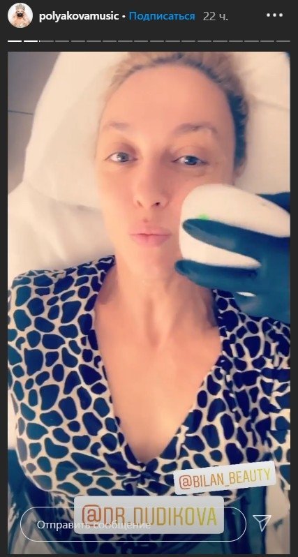 Оля Полякова попала впросак на "Танцах со звездами"