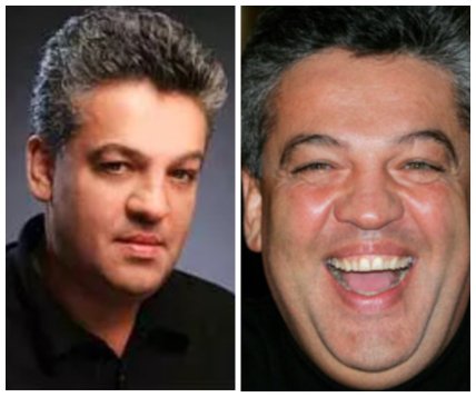 Игорь Лихута до и после пластики