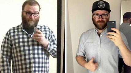 До и после: как меняется внешность человека, который бросил пить (Фото)