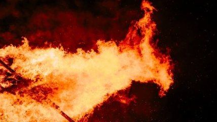 Чуть не сгорели заживо: На Прикарпатье детей госпитализировали с ожогами