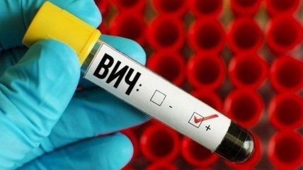 В Украине за месяц зарегистрировали более 1200 новых случаев ВИЧ