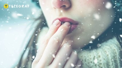Зимой губы нужно тщательно увлажнять (изображение создано с помощью ИИ)