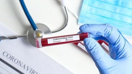 СМИ: уханьские ученые хранили образцы коронавируса с 2013 года 