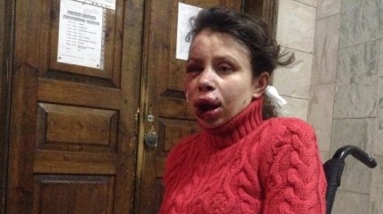 МВД: В деле об избиении журналистки Чорновил появилась новая статья
