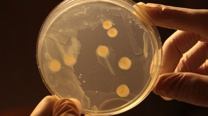 Ученые выяснили, как охотятся хищные бактерии  