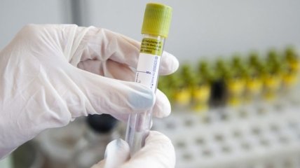 Кількість заражених коронавірусом у Бельгії зросла до 239