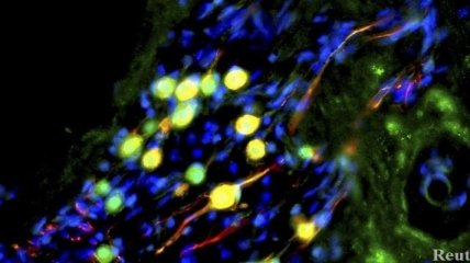 Ученые создали легкое из стволовых клеток