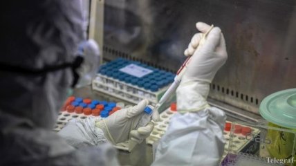 На Сумщині лабораторно підтверджено перший випадок коронавірусу