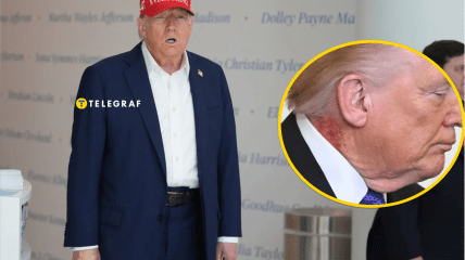 На шиї Дональда Трампа помітили червону пляму