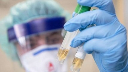 На Харківщині виявили 30 нових випадків коронавірусу