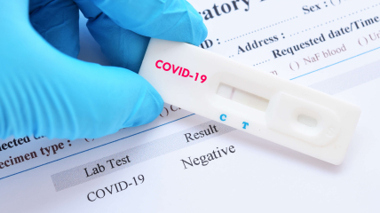 Експрес-тест на коронавірус може показати одну або дві смужки.