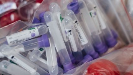 Україна у списку країн з високими темпами поширення COVID-19