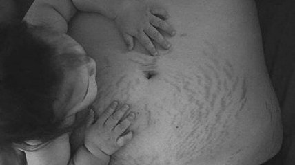 Женщины показали, как на самом деле выглядит их тело после родов (Фото) 