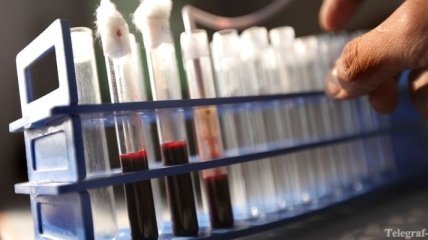 Статус человека можно определить по крови - ученые