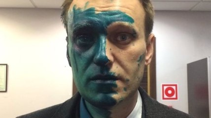 Навальный заявил, что может ослепнуть на один глаз из-за зеленки