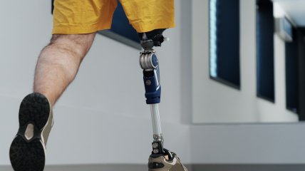 В Украине заработала пилотная версия онлайн-хаба "Є-протез"