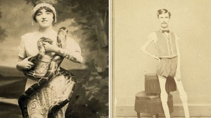 Суровый XIX век: коллекция архивных снимков людей с деформациями (Фото)