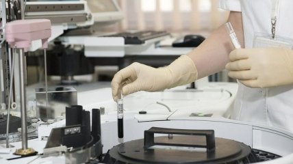 Франція виділить додаткові €5 мільярдів на дослідження коронавірусу