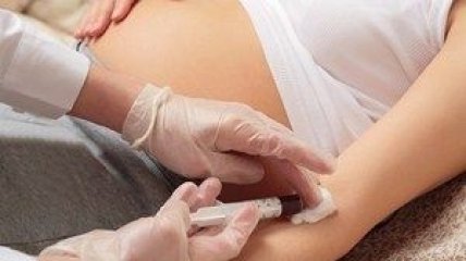 Синдром Дауна во время беременности покажет анализ крови