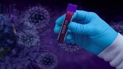 У листопаді будуть такі піки, що всі прозріють: інфекціоніст озвучила прогноз по пандемії коронавірусу в Україні