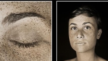 Искусство фотографии: изъяны кожи людей на снимках Пьера-Луи Феррера (Фото)