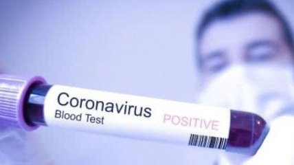 Первый случай коронавируса выявлен в Черниговской области