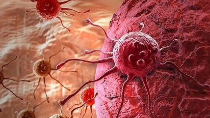 Компьютерный алгоритм поможет ученым обнаружить опасные раковые клетки