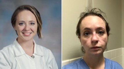 COVID - жестокая болезнь, ее врагу не пожелаешь: рассказ американской медсестры покорил сеть