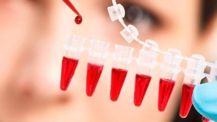 Анализ крови заменят анализом пота с помощью электронного пластыря