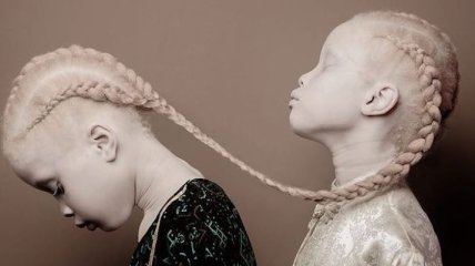 Уникальная красота: 11-летние сестры-альбиносы покоряют мир моды (Фото)
