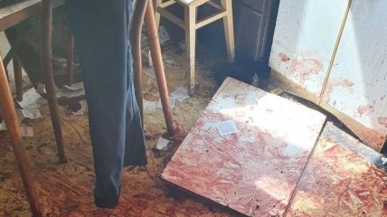 В России мужчина вышел из запоя, избил жену и отрезал себе пенис, а потом стоял с ним на улице (фото и видео)
