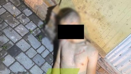 В Одессе мужчина получил выстрел в голову после попытки украсть бампер (фото 18+)