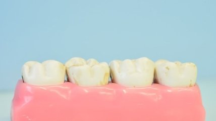 На чипе: ученые создали уникальный искусственный зуб