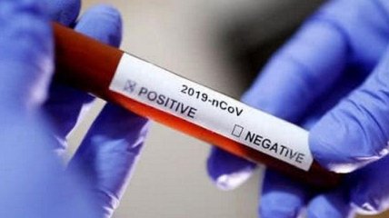 У Вірменії зафіксували перший випадок коронавірусу