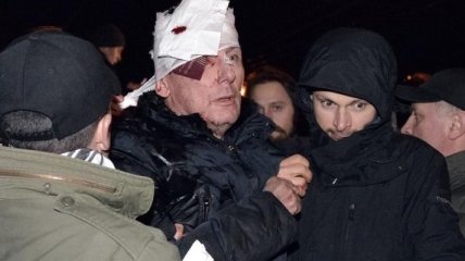 Киевские наркологи заявили об опьянении Юрия Луценко 10 января