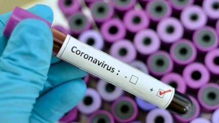 В Україні є достатньо тест-систем для виявлення коронавірусу