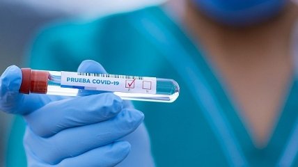 На Херсонщине за сутки не зафиксировано новых случаев коронавируса