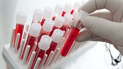 Онкологию можно диагностировать по анализу крови 