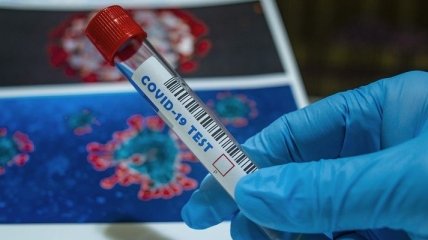 В Україні вже понад 24 тис. випадків коронавірусу, з них за добу - 340