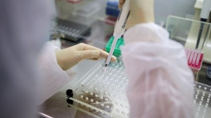 Украинцам подсказали, как бесплатно сдать тест на антитела к коронавирусу