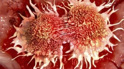 Ученые смогли проследить за "рождением" раковой клетки