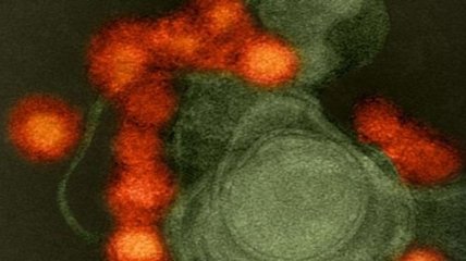 Выявлены "боевые" белки вируса Зика