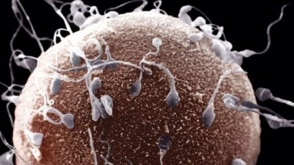 Ученые создали образцы спермы человека из клеток кожи