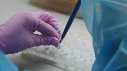 В Україні за добу зафіксували 259 коронавірусу