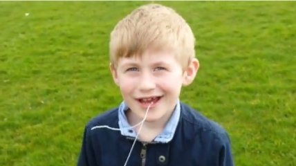 Отец удалил сыну зуб с помощью игрушечного вертолета (ВИДЕО)