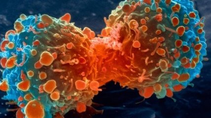 Ученые нашли генетическую связь между метаболизмом и раком
